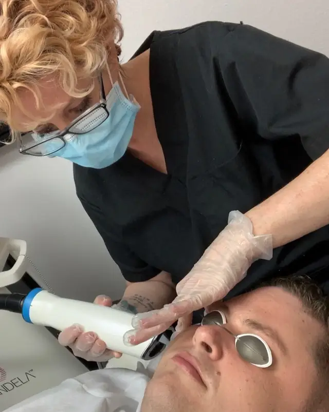 Donna in scrubs guiding the Candela handpiece across a client's cheek, eye shields on